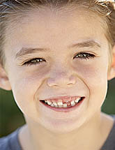 photo of a smiling young boy with several missing baby teeth