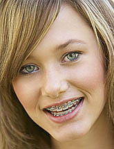 photo of a smiling teenage girl wearing braces